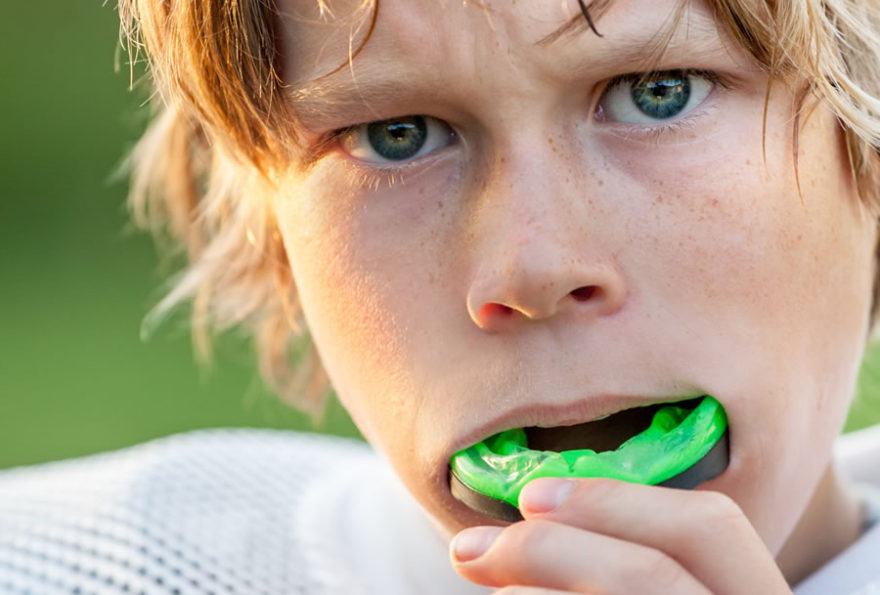 Custom-Made Mouthguards Melbourne | Denture Care Centre